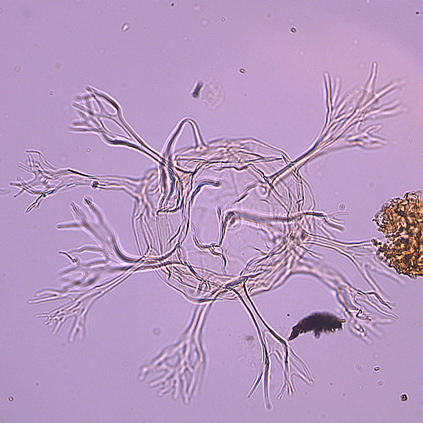 Oligosphaeridium_pulcherimum_U1580_38R-5_90 kopie.jpg